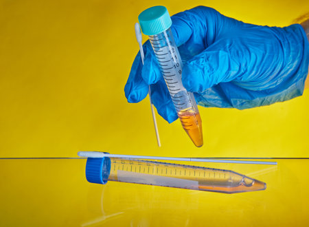 Coronavirus test - Medical worker with test tube and swab swab for coronavirus sample wearing protective gloves. COVID-19, oral and nasal specimen collection, health and safety.の写真素材