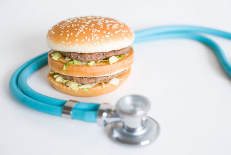 Hamburger and medical stethoscope on a white background, copy space. Health effects of junk foodの写真素材