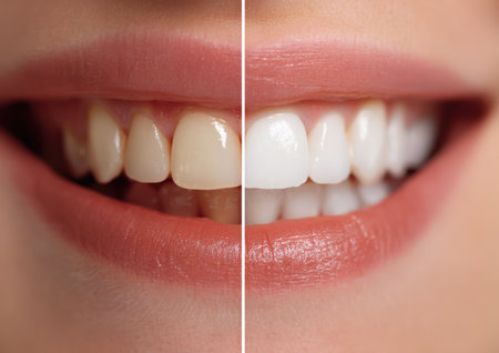 Smiling woman displays teeth comparison, illustrating whitening results and dental care, emphasizing the importance of oral hygiene and aesthetic enhancementの素材