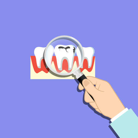 Finding problem teeth, caries, dirty enamel. Magnifying glass in hand. Tooth with caries icon on isolated background. EPS 10 vectorのイラスト素材