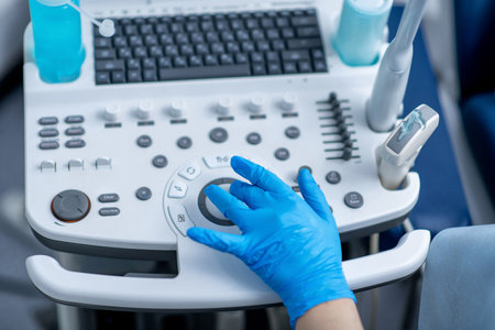 Ultrasound machine in the hands of a doctor. Medical equipment.の写真素材
