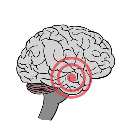 Brain in vector. Headache. Place of pain in brain.のイラスト素材