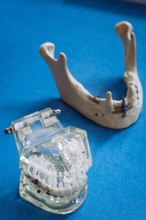 A plastic model of the jaw for prosthetics lies on the table. On a blue background.の写真素材