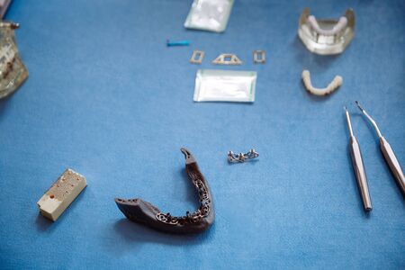 Plastic jaw model for stomatology and maxillofacial surgery.の写真素材