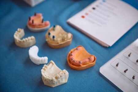 Plastic jaw model for stomatology and maxillofacial surgery.の写真素材