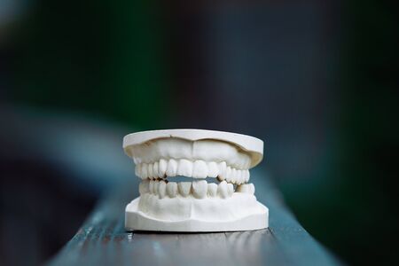 A plastic model of the jaw for prosthetics lies on the table. On a blue background.の写真素材