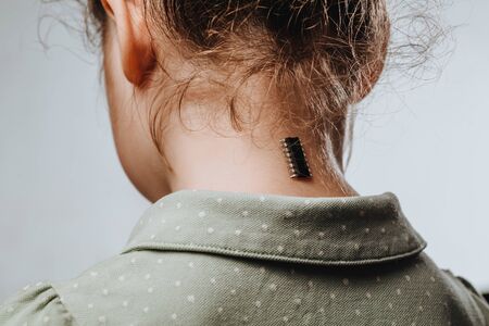 Implantation of chip under the human skin. Microchip is connected to the girl body. Concept of future technologies aimed at tracking and identifying people.の写真素材