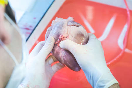 medical practice for students. open heart surgery. Stitching of vessels and stopping of bleedingの写真素材