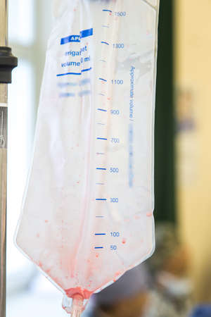 Blood transfusion in medicine,patien with bleedingの写真素材
