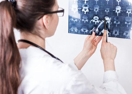 Young woman brunette doctor in glasses and a medical white coat examines an x-ray shot on a white...