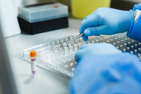 Opening a capsule with potent chemicals with human blood plasma preparations at the DNA Research Centerの写真素材