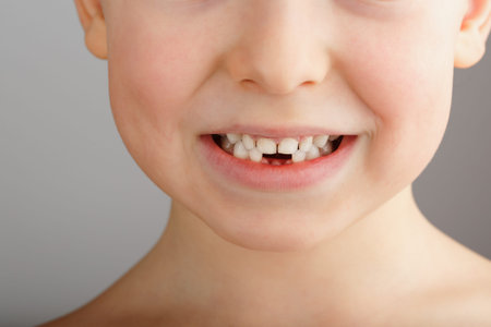 A child's smile without lower baby teeth. A hole in a child's smile. Fun concept. Dental service