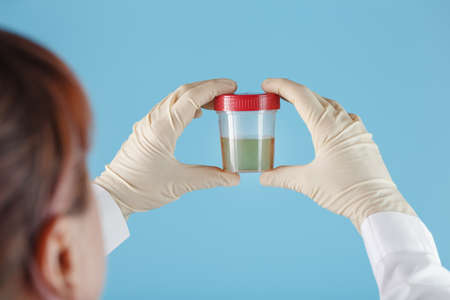The doctor's gloved hand holds a transparent container with a urine test. Free space on a blue backgroundの写真素材
