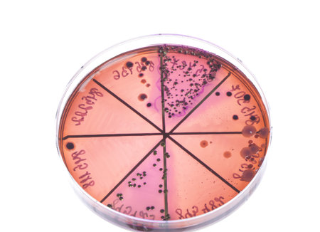 Petri dish close up. Bacteria culture.