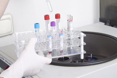 Hand in glove loading blood tubes in centrifuge