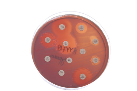 Petri dish close up. Bacteria culture.
