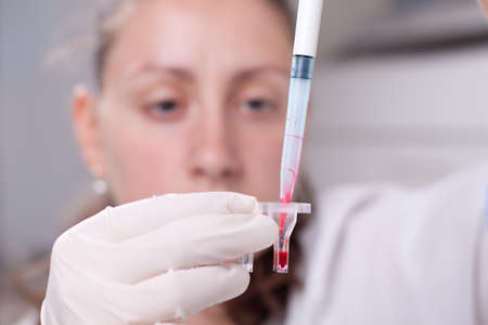 Woman dropping blood simple with micro pipette in test containerの写真素材