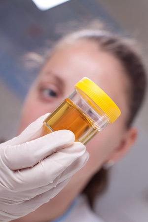 Woman examin urine container in laboratory environmentの写真素材