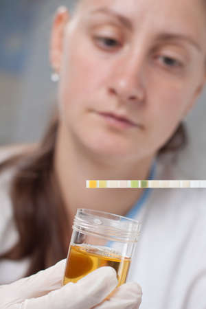 Woman making urine test with ph material in laboratoryの写真素材