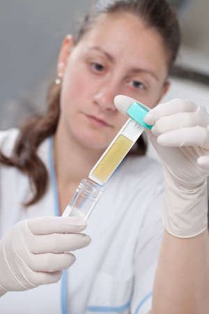 Lab scientist doing research on petri dishの写真素材