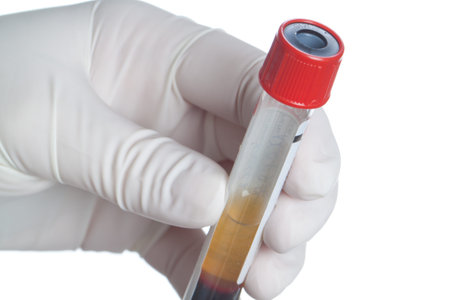 Hand in glove holding test tube full of blood