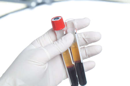 Hand in glove holding test tube full of bloodの写真素材