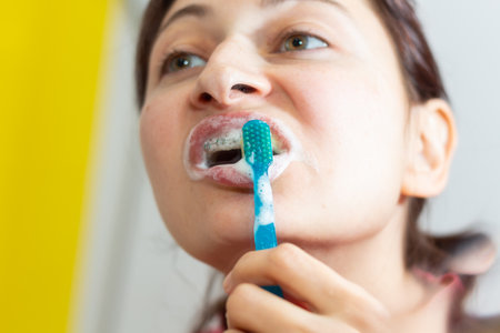 Girl with dental braces and brackets holding toothbrush for dental hygieneの写真素材