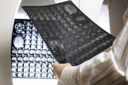 Doctor holding a picture of a brain MRI workflow in diagnostic hospital