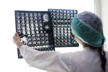 Doctor holding a picture of a brain MRIの写真素材