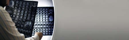 Doctor holding a picture of a brain MRIの写真素材