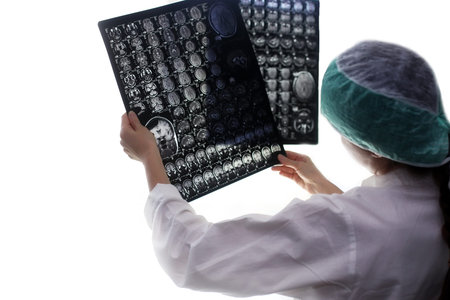 Doctor holding a picture of a brain MRIの写真素材
