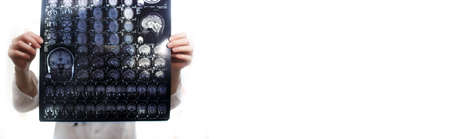 Doctor holding a picture of a brain MRIの写真素材