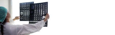 isolated poster with doctor holding a picture of a brain MRI workflow in diagnostic hospitalの写真素材