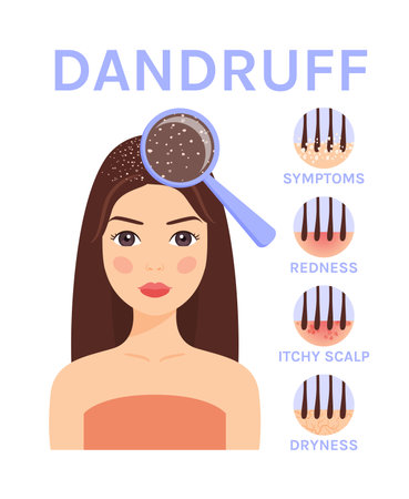 Dandruff and Magnifying Glass on the Head of pretty Woman.Disease and Treatment of the Scalp and Hair.Symptoms of dandruff.Flat color cartoon style. White background.Illustration for medical design.のイラスト素材