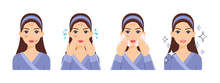 Attractive Girl take Care of her Problem Skin. Acne and Pimple Treatment. The Woman Washes her Face and applies Soapy Foam.のイラスト素材