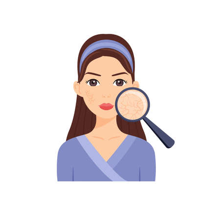 Beautiful Brunette with Dry Skin on her Face. Magnifying Glass and Problem skin Close-up. Flat cartoon color fashion style. White background. Vector illustration.のイラスト素材