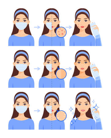 A beautiful brunette wears a medical mask.Skin problems.Pimples, close-up pimples and sunburn, clean face. Flat cartoon color style.White background.Vector illustration.のイラスト素材
