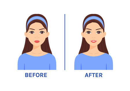 Pretty Woman with a Big Nose. Correction and Plastic Surgery. before after. Beautiful Little nose and Happy Lady. Smile on face. cartoon style. white background. Vector illustration for Medical Designのイラスト素材