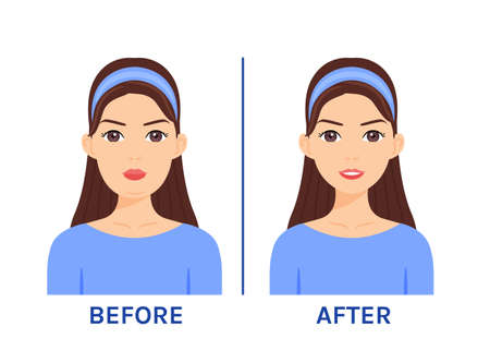 Beautiful Woman with Fat Face. Overweight and Double Chin. Treatment and Surgery. before after. Happy Slim Lady. Smile on Female Face. cartoon style. Vector illustration for Medical and Beauty design.のイラスト素材