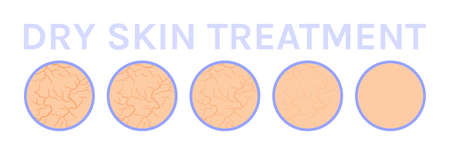 Dry Skin Icon. Cracks on skin. close up. treatment and steps. before after. Healthy and Soft skin. Effect of Cream and Moisturizer Mask. white background. Vector Illustration for beauty design.のイラスト素材
