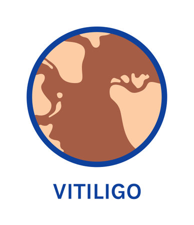 Vitiligo. skin disease. Pigmentation. Icon on a White background. zoom. Color fashion style. Vector illustration for Medical and Education Design.のイラスト素材