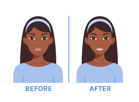 Portrait of Beautiful Plump Black Woman. Double Chin. Slimming and Weight Loss. before and after. Pretty Slim Afro Lady with a Smile on Face. Color cartoon style. white background. vector illustrationのイラスト素材