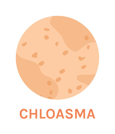 Chloasma. A Skin Problem and Disease. Pigmentation and Freckles on Human Skin. Melasma in Close up. zoom. Circle Icon. color image. Vector illustration for Medical Design.のイラスト素材