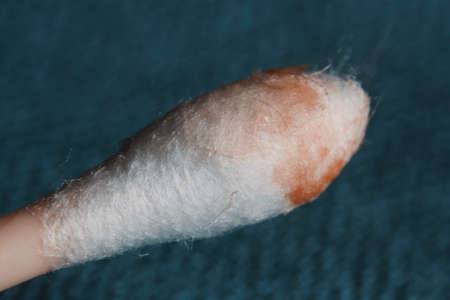 Earwax on a cotton swab, macro photo. Earwax, also known by the medical term cerumen, is a brown, orange, red, yellowish or gray waxy substance secreted in the ear canal of humans and other mammals.の写真素材