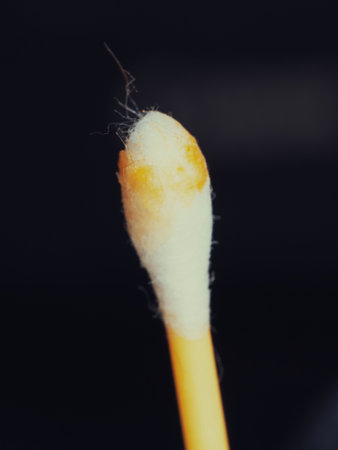 Earwax on a cotton swab, macro photo. Earwax, also known by the medical term cerumen, is a brown, orange, red, yellowish or gray waxy substance secreted in the ear canal of humans and other mammals.の写真素材