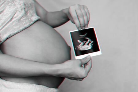 photo of a pregnant ultrasound in the hands of a pregnant girl on the background of the abdomen....