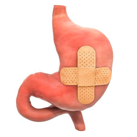 Human stomach with adhesive bandages. Treatment of stomach concept, 3D rendering isolated on white...