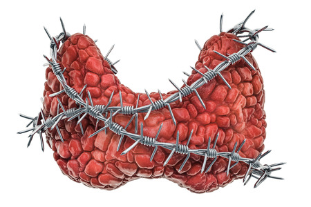 Human thyroid with barbed wire. Thyroid disease concept. 3D rendering isolated on white background