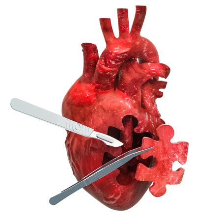 Heart surgery concept, 3D rendering