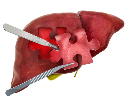 Liver or gallbladder surgery concept, 3D rendering isolated on white backgroundの写真素材